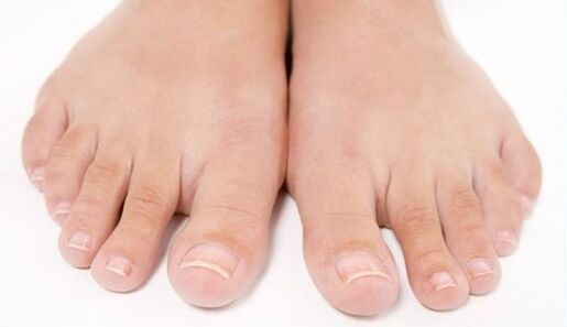 pés saudáveis ​​após tratamento de fungos