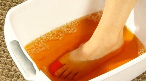 banho de iodo contra fungos nos pés